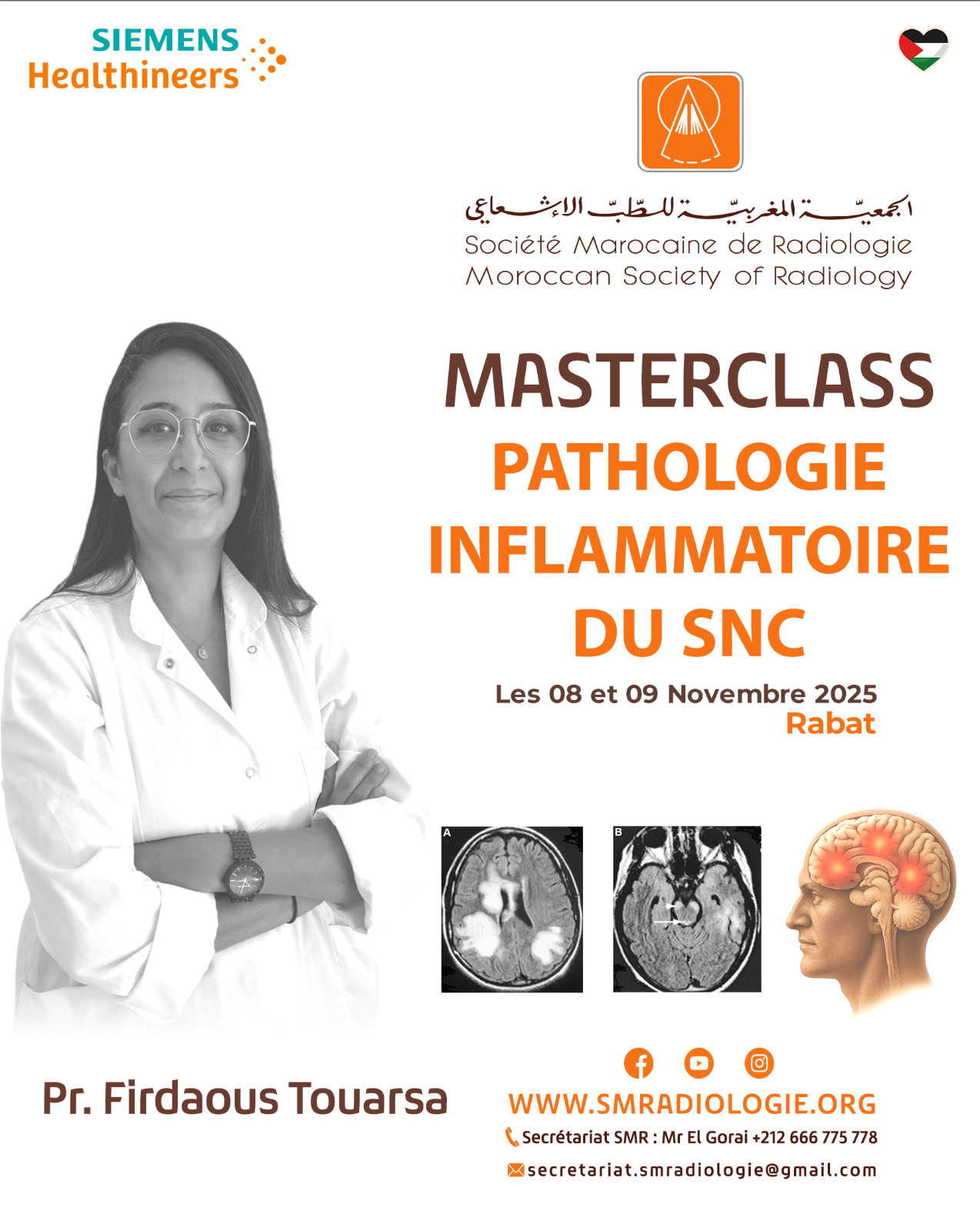 Masterclass patgologie inflammatoire du snc