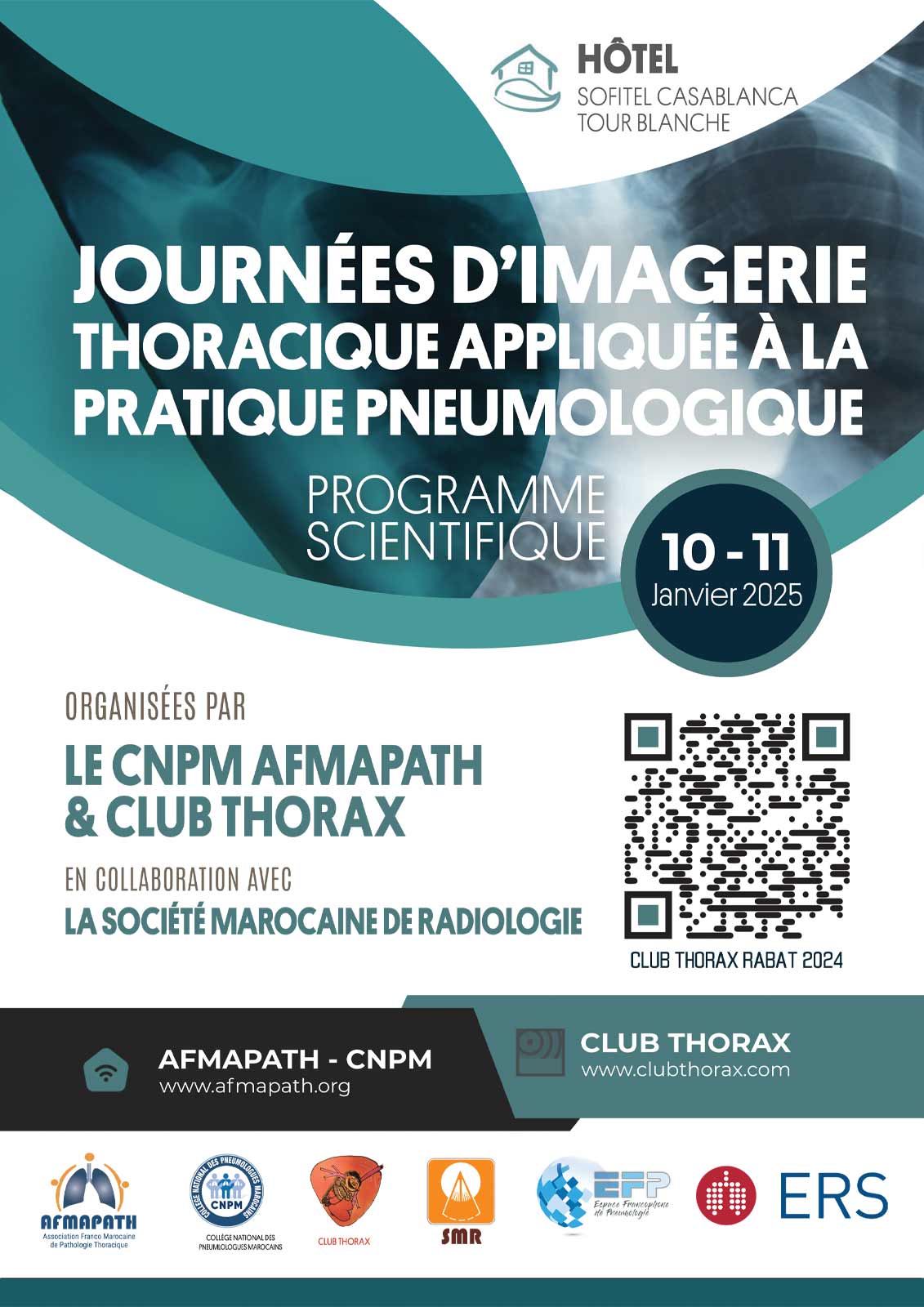 Journées d'imagerie thoraciques appliquée à la pratique pneumologique