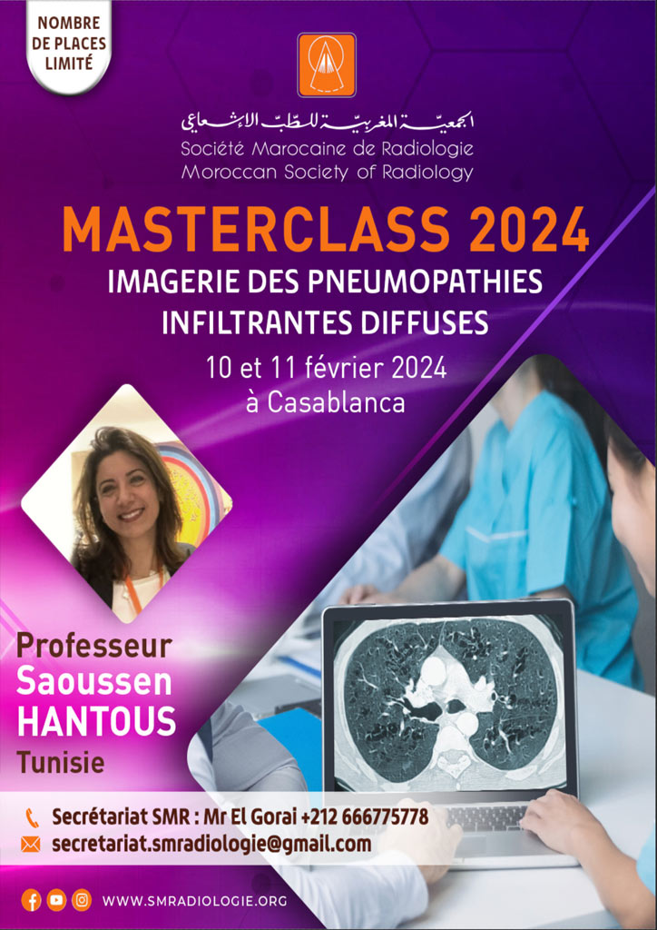 IMAGERIE DES PNEUMOPATHIES - INFILTRANTES DIFFUSES