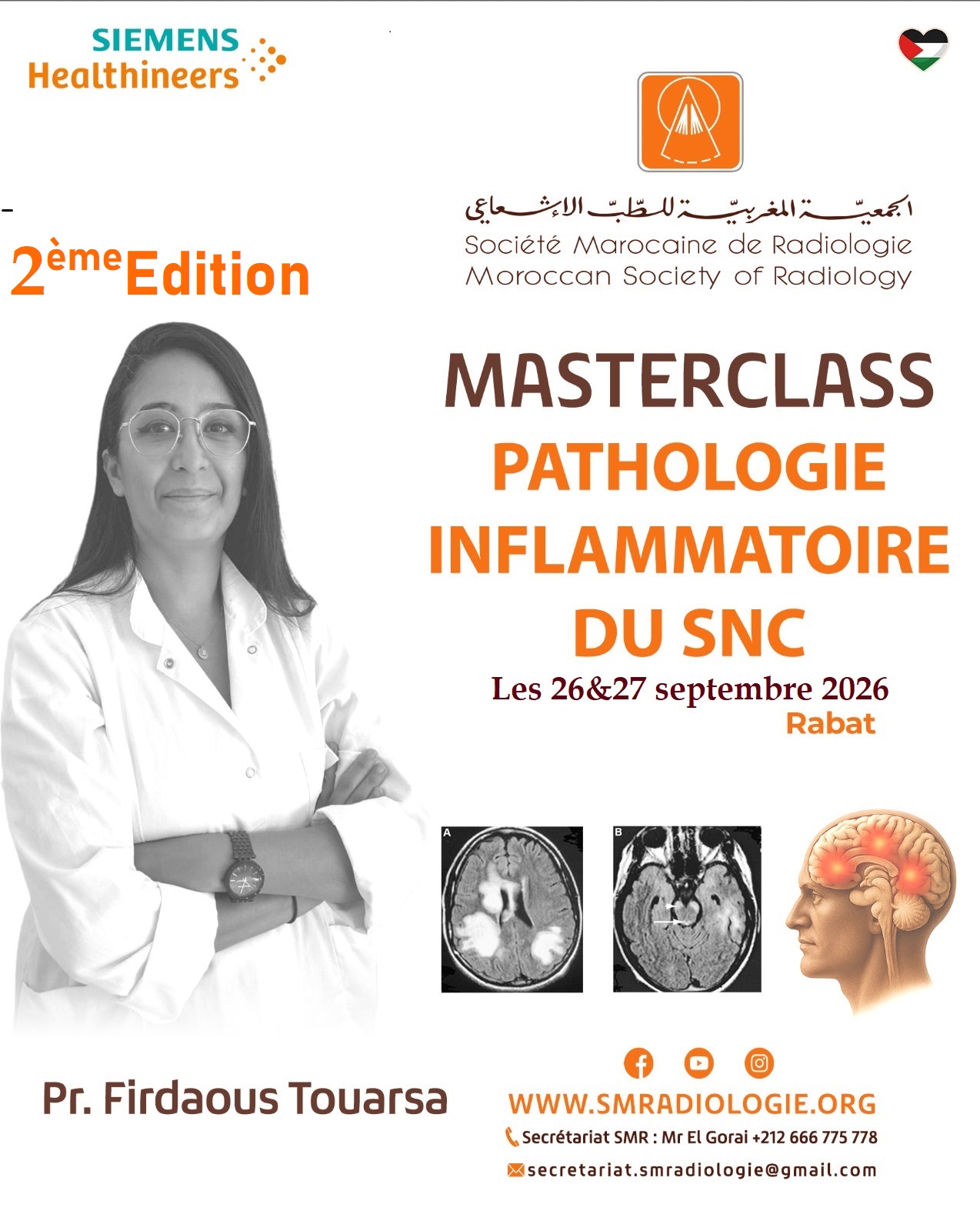 Masterclass pathologie inflammatoire du snc